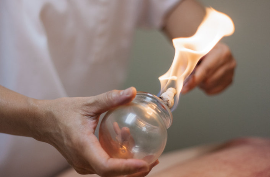 WORKSHOP: CUPPING THERAPY II